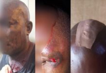RE: MAN ALLEGEDLY STABBED BY POLICEMEN IN DELTA BATTLES FOR LIFE