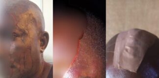 RE: MAN ALLEGEDLY STABBED BY POLICEMEN IN DELTA BATTLES FOR LIFE