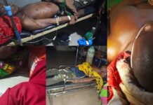 Edo: A gun duel between security operatives and Kidnappers in Afuze leaves 3 hospitalized over gun shot injuries