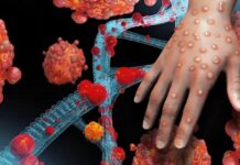 Cross River records two more Mpox cases