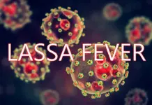Nigeria Battles Health Emergency as Lassa Fever Claims 155 Lives