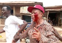 Many Injured as Violence Erupts at APC Ward Congress in Oluyole